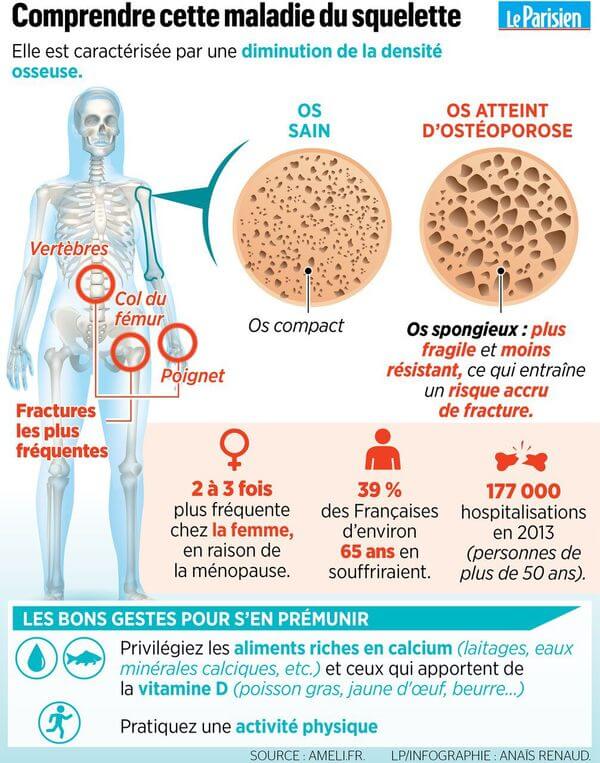 Qu'est-ce que l'ostéoporose