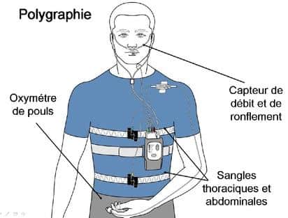polygraphie ventilatoire nocturne large - Illustration nastent.fr